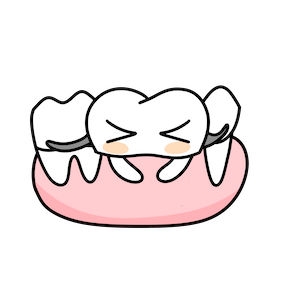 ทันตกรรมประดิษฐ์